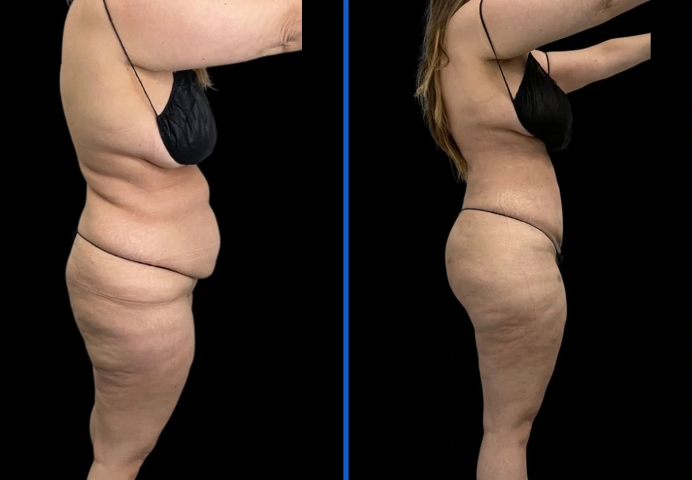 360-12|Exert Clinic