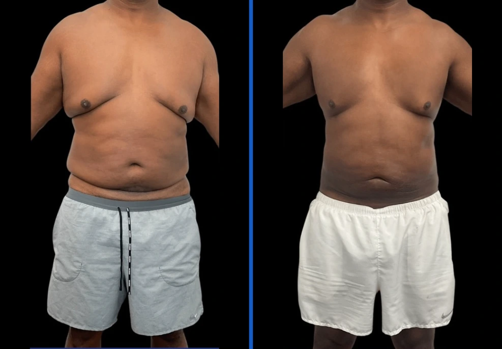 360-2|Exert Clinic