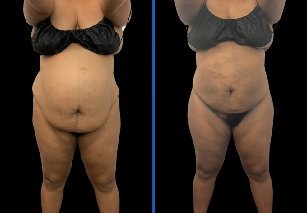 360-5|Exert Clinic