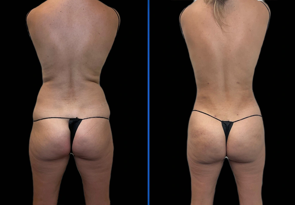 test|Exert Clinic