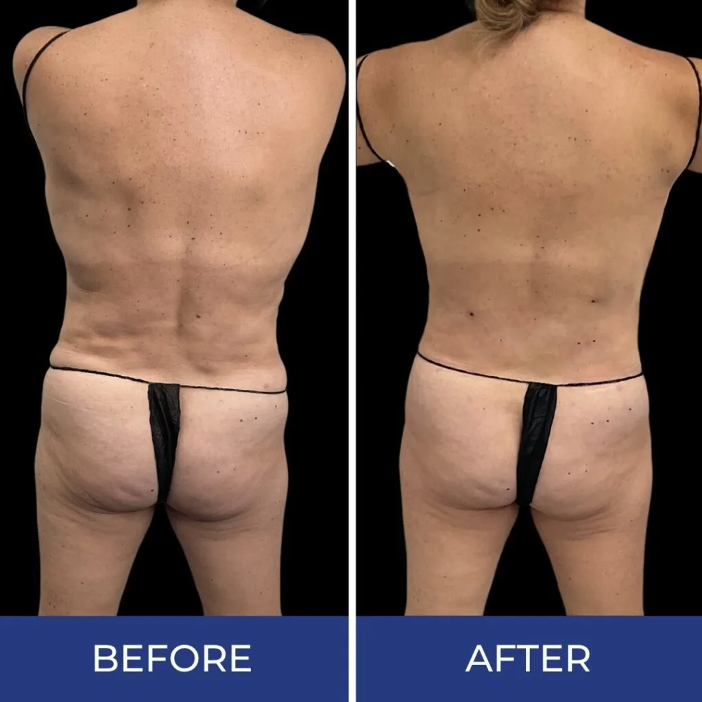 3|Exert Clinic