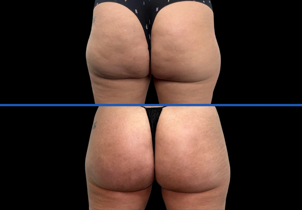 5aveli|Exertclinic