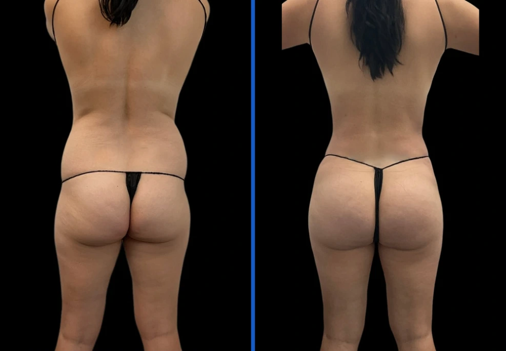 xpressbbl|Exert Clinic