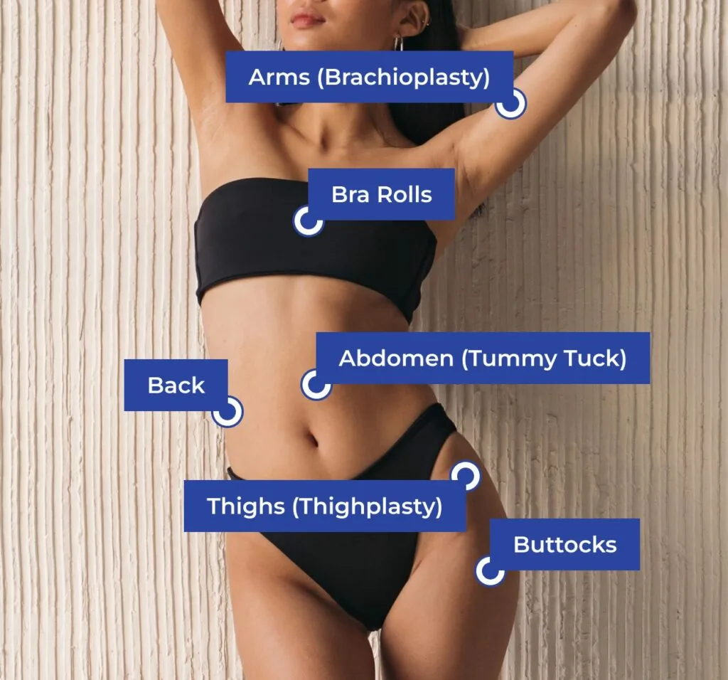 Target Areas for Body Lift Massive Weight loss Banner