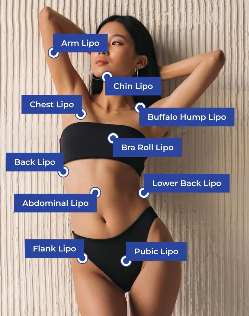 Xpress Liposuction Target Areas​
