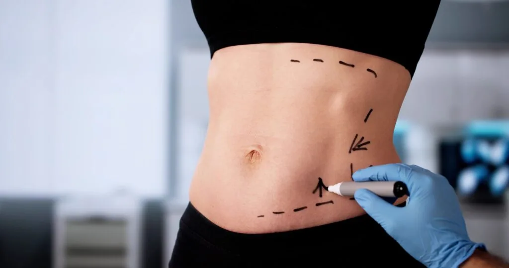 How Painful Is Liposuction? Banner