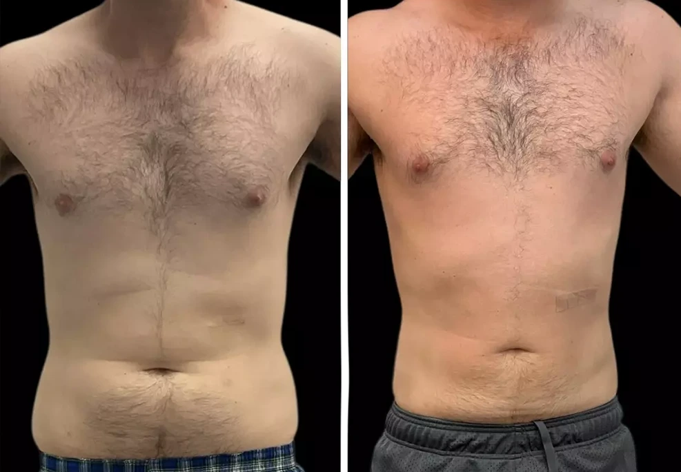360-male.webp