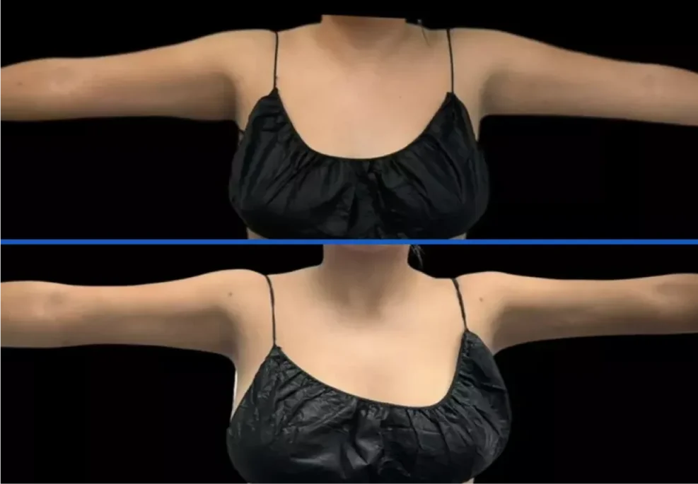 arms2.jpg-2.webp